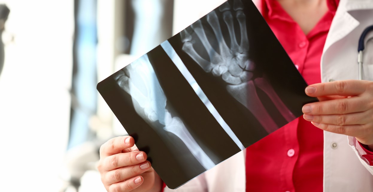 Ne čakajte z rehabilitacijo po prometni nesreči