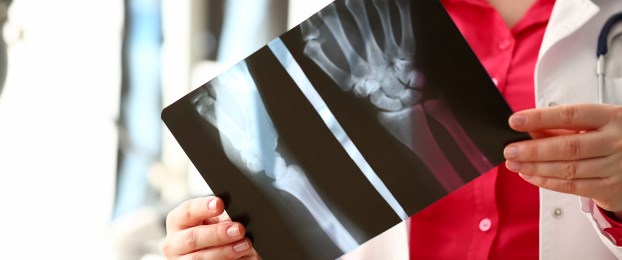 Ne čakajte z rehabilitacijo po prometni nesreči