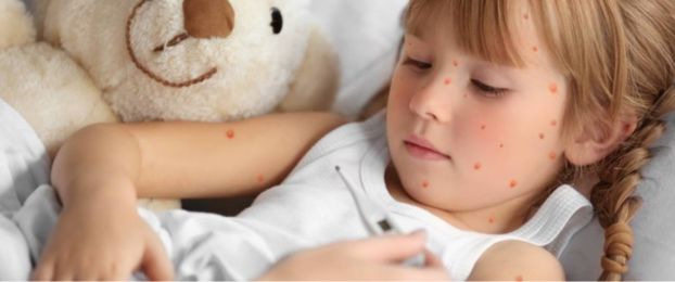 Izpu&scaron;čaji pri otroku &ndash; nalezljive bolezni
